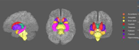 La dépression touche 1 personne sur 5 au cours de la vie