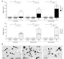 Environ 30% des patients atteints d'épilepsie connaissent toujours des crises et sont donc touchés d’« épilepsie réfractaire »