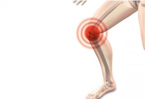 En décryptant ce processus médié par l’inflammation de l’articulation et par une augmentation de l'écoulement de fluides du cartilage, cette étude ouvre une nouvelle voie de détection du risque d’arthrose post-traumatique En décryptant ce processus médié par l’inflammation de l’articulation et par une augmentation de l'écoulement de fluides du cartilage, cette étude ouvre une nouvelle voie de détection du risque d’arthrose post-traumatique