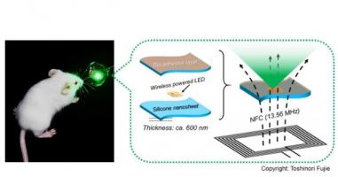 Ce nouveau dispositif pourrait offrir un traitement anticancéreux efficace et peu invasif adapté aux organes délicats Ce nouveau dispositif pourrait offrir un traitement anticancéreux efficace et peu invasif adapté aux organes délicats.