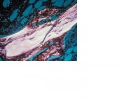 Ce ligand particulier se lie à une cellule de livraison pour activer la guérison osseuse dans une cellule adjacente. Ce ligand particulier se lie à une cellule de livraison pour activer la guérison osseuse dans une cellule adjacente.