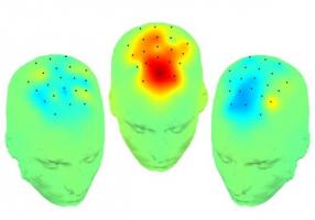 Ces enregistrements cérébraux peropératoires qui identifient une nouvelle connexion cérébrale révèlent aussi une cible prometteuse pour l'amélioration des symptômes cognitifs Ces enregistrements cérébraux peropératoires qui identifient une nouvelle connexion cérébrale révèlent aussi une cible prometteuse pour l'amélioration des symptômes cognitifs