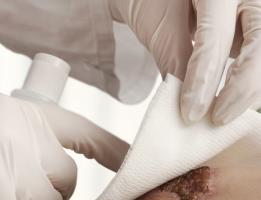 Ce projet primé va permettre une meilleure gestion de l’exsudat et le développement de pansements toujours plus efficaces. Ce projet primé va permettre une meilleure gestion de l’exsudat et le développement de pansements toujours plus efficaces.