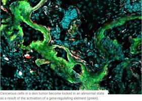 Un mécanisme partagé par le processus de cicatrisation des plaies et le développement des tumeurs vient d'être mis en lumière Un mécanisme partagé par le processus de cicatrisation des plaies et le développement des tumeurs vient d'être mis en lumière