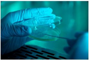 On sait que les ulcères du pied diabétique sont parmi les plaies les plus longues à cicatriser. Ils mettent entre 90 et 150 jours pour guérir. On sait que les ulcères du pied diabétique sont parmi les plaies les plus longues à cicatriser. Ils mettent entre 90 et 150 jours pour guérir.