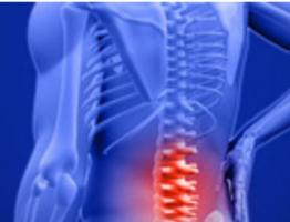 La lombalgie est une condition extrêmement courante qui va toucher au moins 80% de la population à un moment de sa vie. 