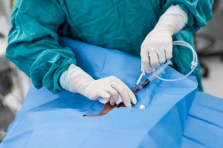 Ce cathéter innovant promet de prévenir les infections sanguines, en particulier celles associées aux cathéters centraux qui tuent chaque année des milliers de personnes dans le monde (Visuel Adobe Stock 113461339)