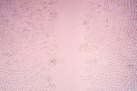 Cette variabilité génétique entre les patients pourrait en effet jouer un rôle déterminant à la fois dans la composition du microbiome des plaies et dans le processus de cicatrisation (Visuel Adobe Stock 172497108)