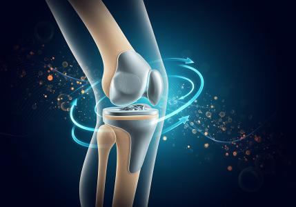 3 études mettent en vant les avantages de l’ostéointégration pour les personnes amputées (Visuel Adobe Stock 1899570321)