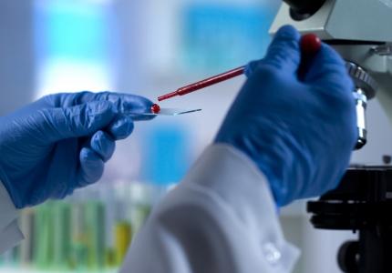 Ce nouveau test permet détecter la présence et d’évaluer l'étendue des lésions cérébrales après un AVC (Visuel Adobe Stock 233950564)