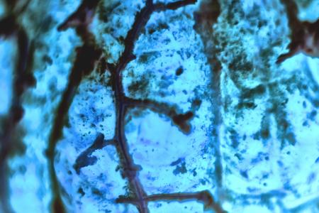 Il suffit de quelques heures aux cellules de mélanome pour échapper au traitement, par inhibiteur de BRAF (Visuel Adobe Stock 251419242)