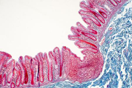 Le tofacitinib répare les défauts de perméabilité intestinale induits par l'inflammation