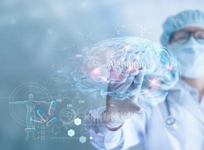 Cette étude permet de mieux comprendre comment l'accumulation de protéines amyloïdes peut favoriser ou contribuer à la perte osseuse liée à l'âge et à la maladie d'Alzheimer (Visuel Adobe Stock 281210653)