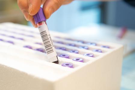 L'étude révèle le rôle clé d’un neurotransmetteur, la somatostatine, dans le contrôle de la toxicité causée par le mécanisme pathogène de la maladie d'Alzheimer (Visuel Adobe Stock 61724653)