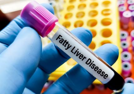 L'étude révèle comment certaines hormones peuvent inverser la stéatose hépatique (Visuel Adobe Stock 764582361)