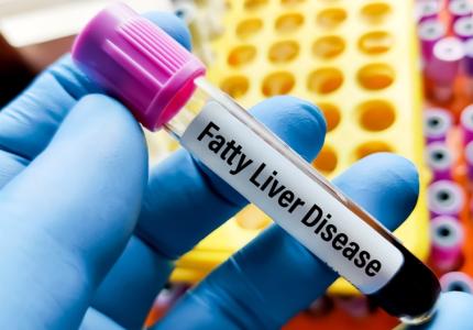 Une consommation excessive et occasionnelle d'alcool pourrait tripler le risque de lésions hépatiques (Visuel Adobe Stock 764582361)