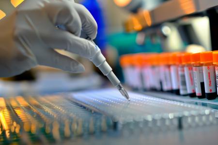 L'ARN non codant, encore peu étudié pourrait être la clé de la régulation des troubles génétiques comme l'épilepsie et l'autisme (Visuel Adobe Stock 832554796)