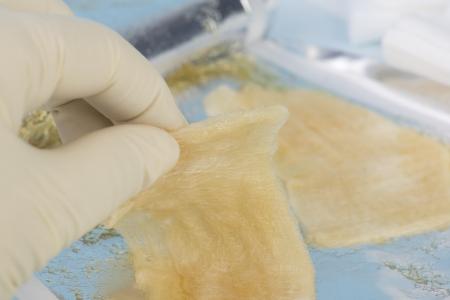 Le gel combiné à un photosensibilisateur, intégré dans le dispositif, une fois activé par la lumière rouge produit des composés réactifs de l'oxygène qui tuent efficacement et donc sur demande, les bactéries et les champignons