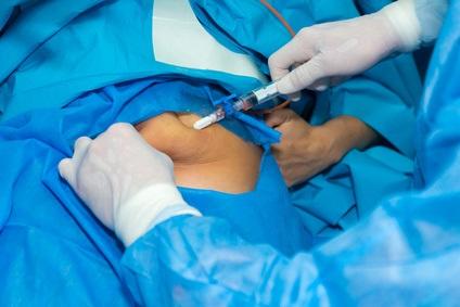 Plébiscitée, au fil des études et des essais, dans des indications de plus en plus larges, la chirurgie bariatrique démontre sa supériorité sur le mode de vie pour la rémission du diabète de type 2 (Visuel Fotolia 178236449)