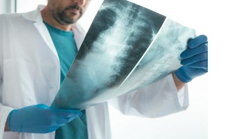 Il s'agit d'une approche révolutionnaire et non invasive basée sur l’utilisation de vésicules extracellulaires et l’outil d’édition du génome CRISPR. En synthèse, une thérapie régénérative, par injection, qui permettrait de reconstruire le disque (Visuel Fotolia 204537701)