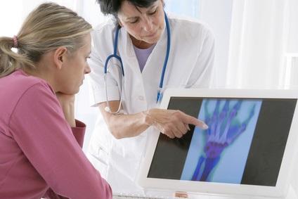 C'est un bilan alarmant qui révèle une augmentation considérable de l’incidence et donc la prévalence de l’arthrose post-ménopause (Visuel Fotolia 36348895)