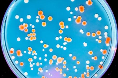 Mais comment la radiorésistance aurait-elle pu évoluer dans plusieurs organismes de notre planète, naturellement protégés du rayonnement solaire par son champ magnétique ? (Visuel Michael M. Cox and coauthors ) 