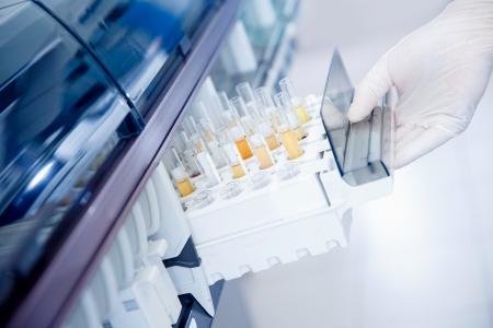 Cette équipe de néphrologues révise, pour plus de précision, la définition de l'hyperfiltration rénale, ou taux de filtration glomérulaire trop élevé, un marqueur biologique de développement de la maladie rénale (Visuel Adobe Stock 334065984)