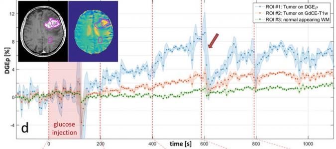 5 morceaux de sucre plutôt que la radioactivité !
