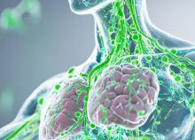 Un flux lymphatique plus rapide dans les jambes pourrait prédire une meilleure réponse aux diurétiques dans l'insuffisance cardiaque aiguë (ViSuel Adobe Stock 1024415085)