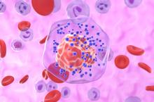 L'étude met en lumière l’impact de l’exposition à des environnements contaminés par des déchets toxiques et dangereux sur le risque de cancer du sein agressif (Visuel Adobe Stock 1031587846)