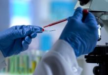 Un test sanguin, qualifié de révolutionnaire, permet de diagnostiquer l'encéphalomyélite myalgique (ME) ou fatigue chronique (CFS : Chronic Fatigue Syndrome), une maladie encore négligée, mal détectée et difficile à diagnostiquée car partageant de nombreux symptômes avec d’autres pathologies (Visuel Adobe Stock 233950564)