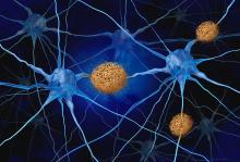 Le médicament restaure la fonction neuronale en empêchant les neurones de produire la protéine bêta-amyloïde toxique (Visuel Adobe Stock 717543805)