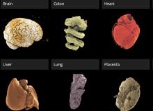 Ce nouveau portail 3D en libre accès permet aux utilisateurs d'explorer des organes humains intacts avec une précision sans précédent (Visuel GOOGLE EARTH screenshot of the Human Organ Atlas portal)